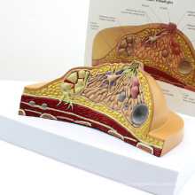 ANATOMY23 (12461) Female Breast Cross-section Model with Common Pathologies,1 Part, Anatomy Models > Female Model